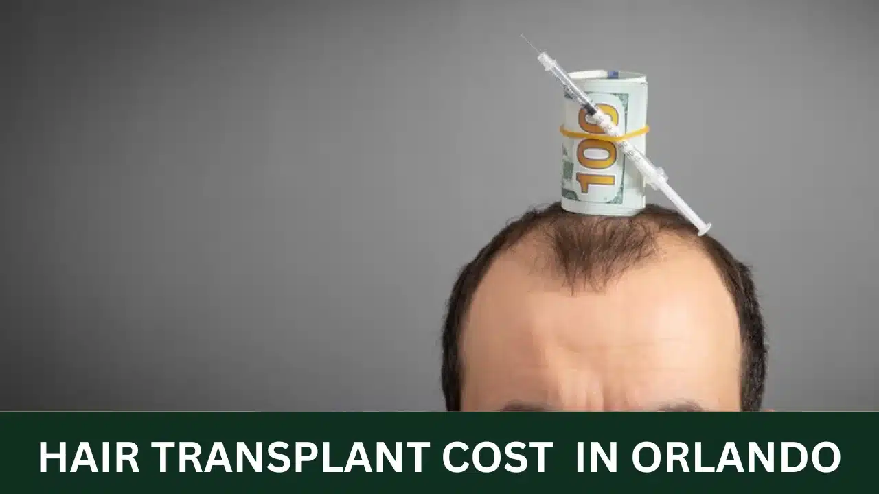 Hair Transplant Cost in Orlando