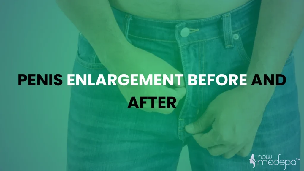 Penis Enlargement Before And After