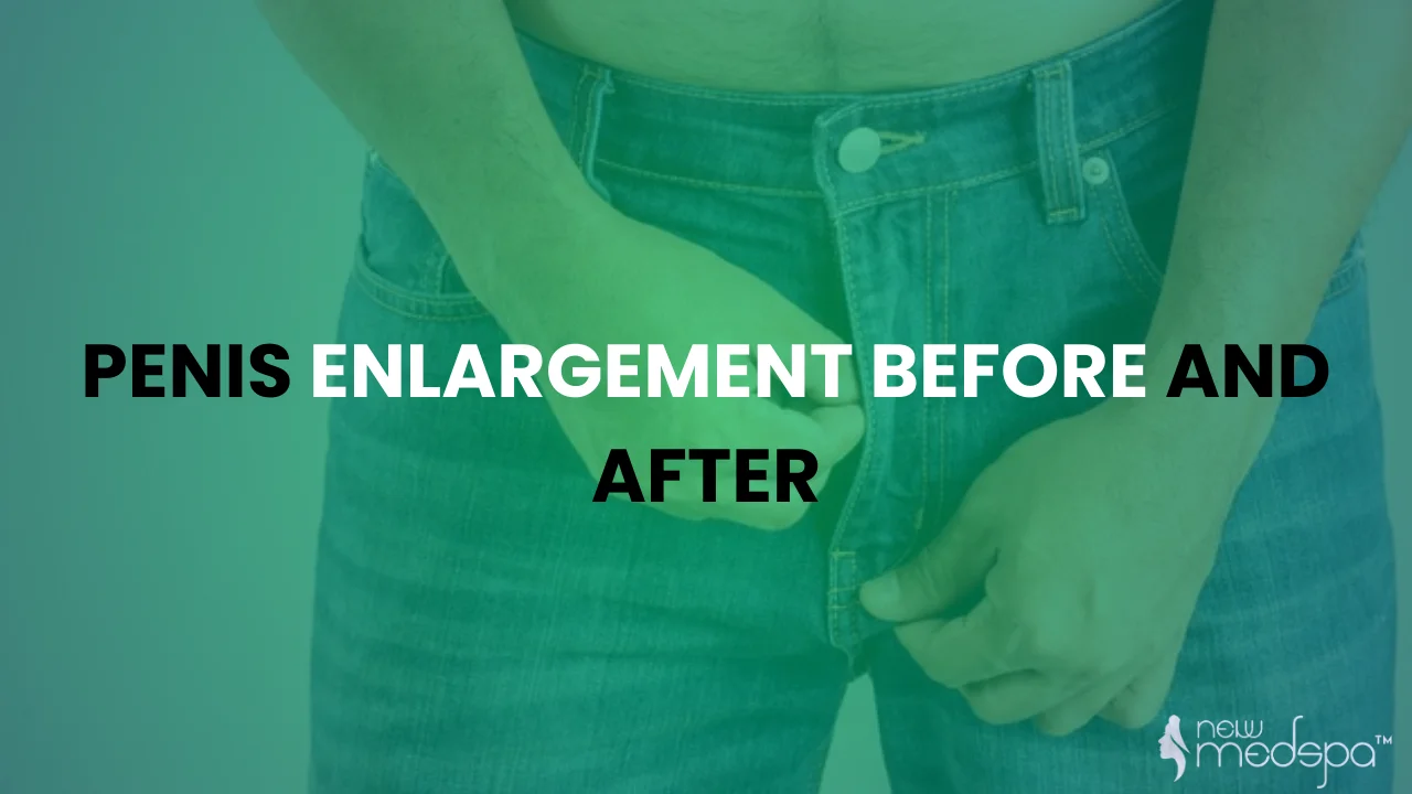 Penis Enlargement Before And After