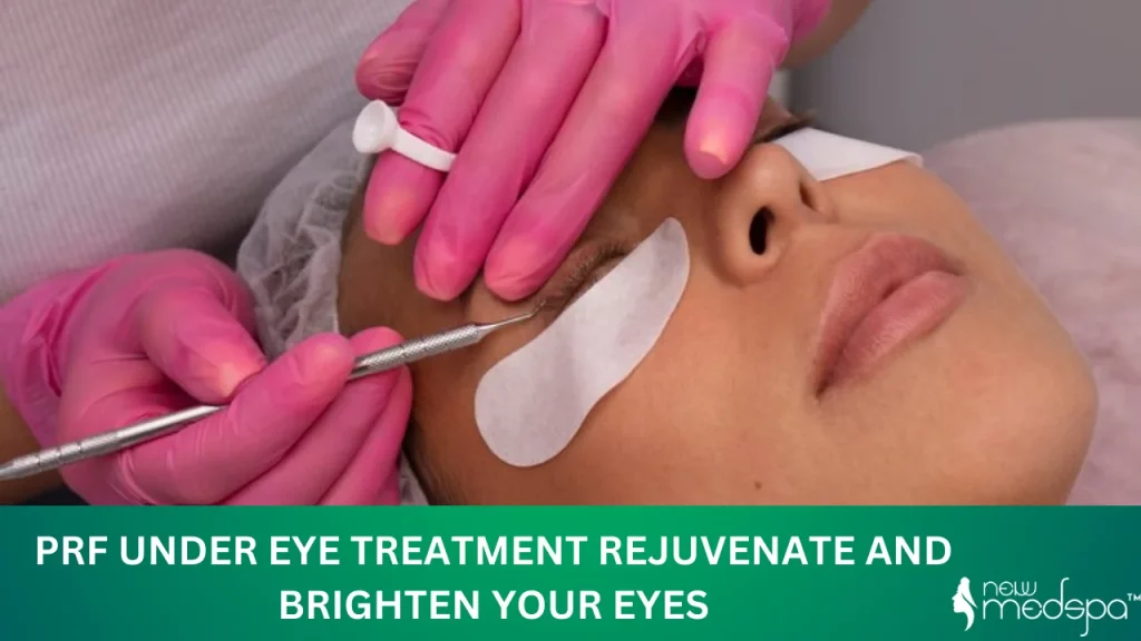 PRF Under Eye Treatment