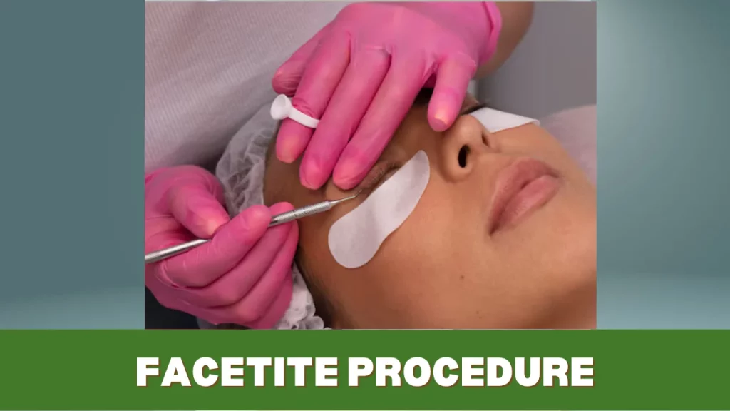 facetite procedure