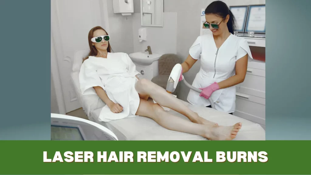 laser hair removal burns