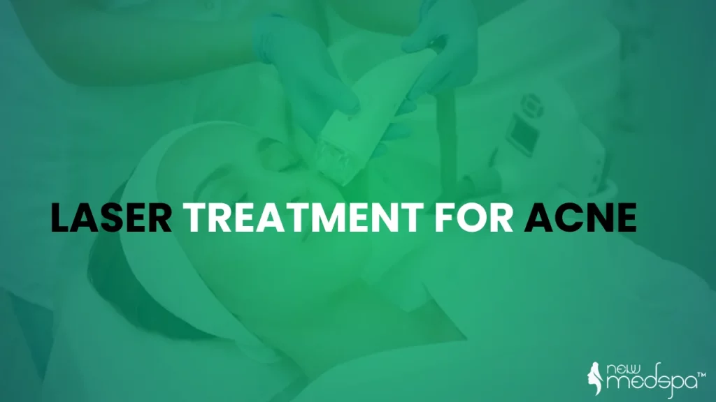 Laser Treatment for Acne