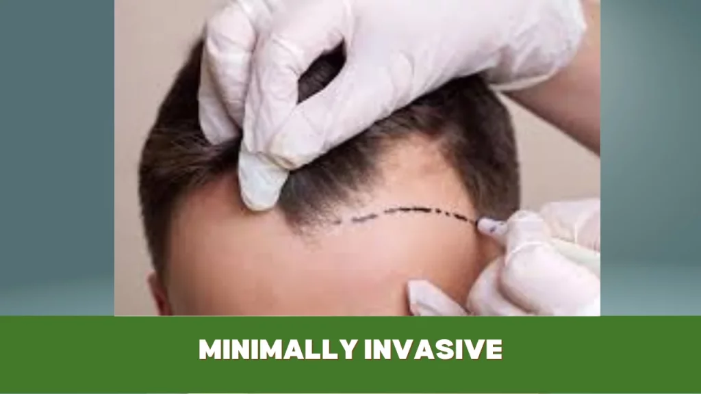 minimally invasive