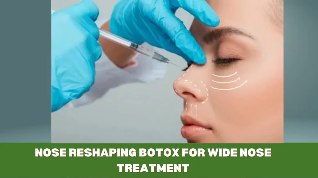 nose reshaping botox for wide nose treatment