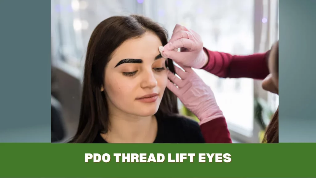 pdo thread lift eyes