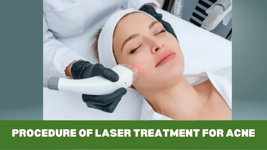 procedure of laser treatment for acne