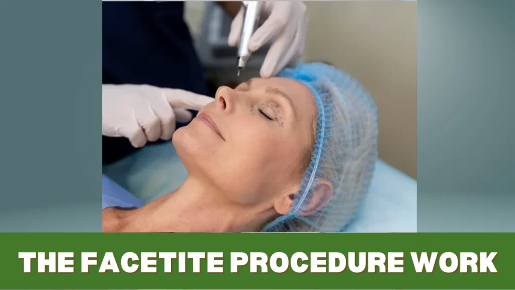 the facetite procedure work