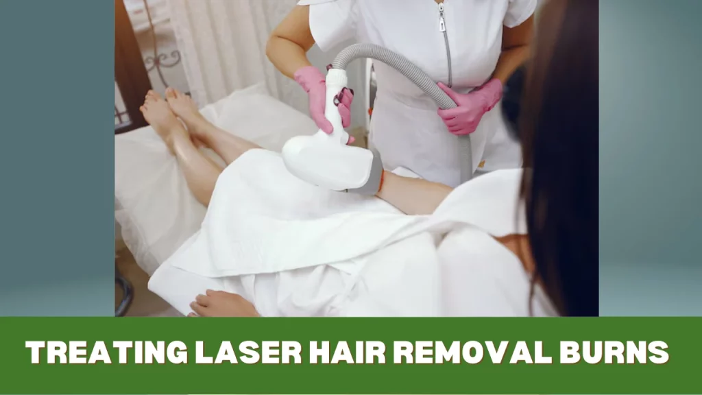 treating laser hair removal burns