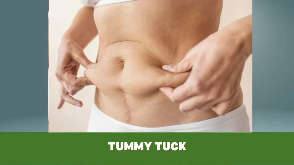 tummy tuck