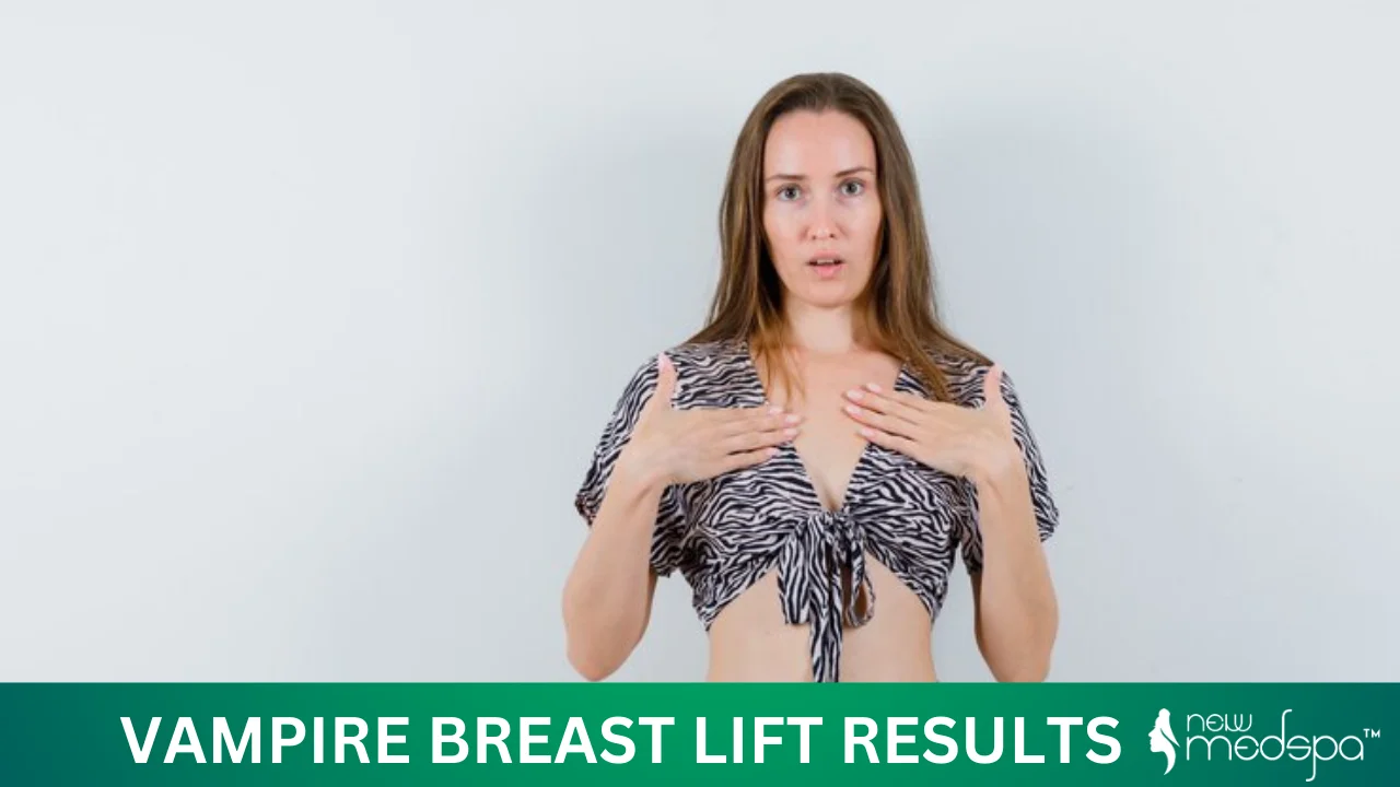 Vampire Breast Lift Results