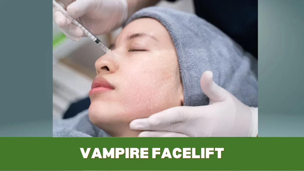 vampire facelift