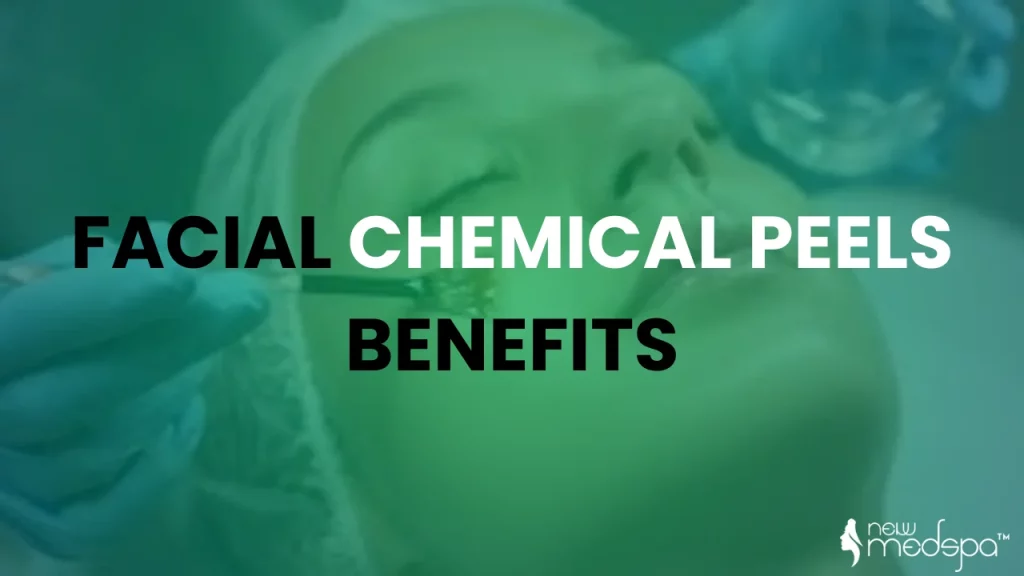 facial chemicals peels benefits