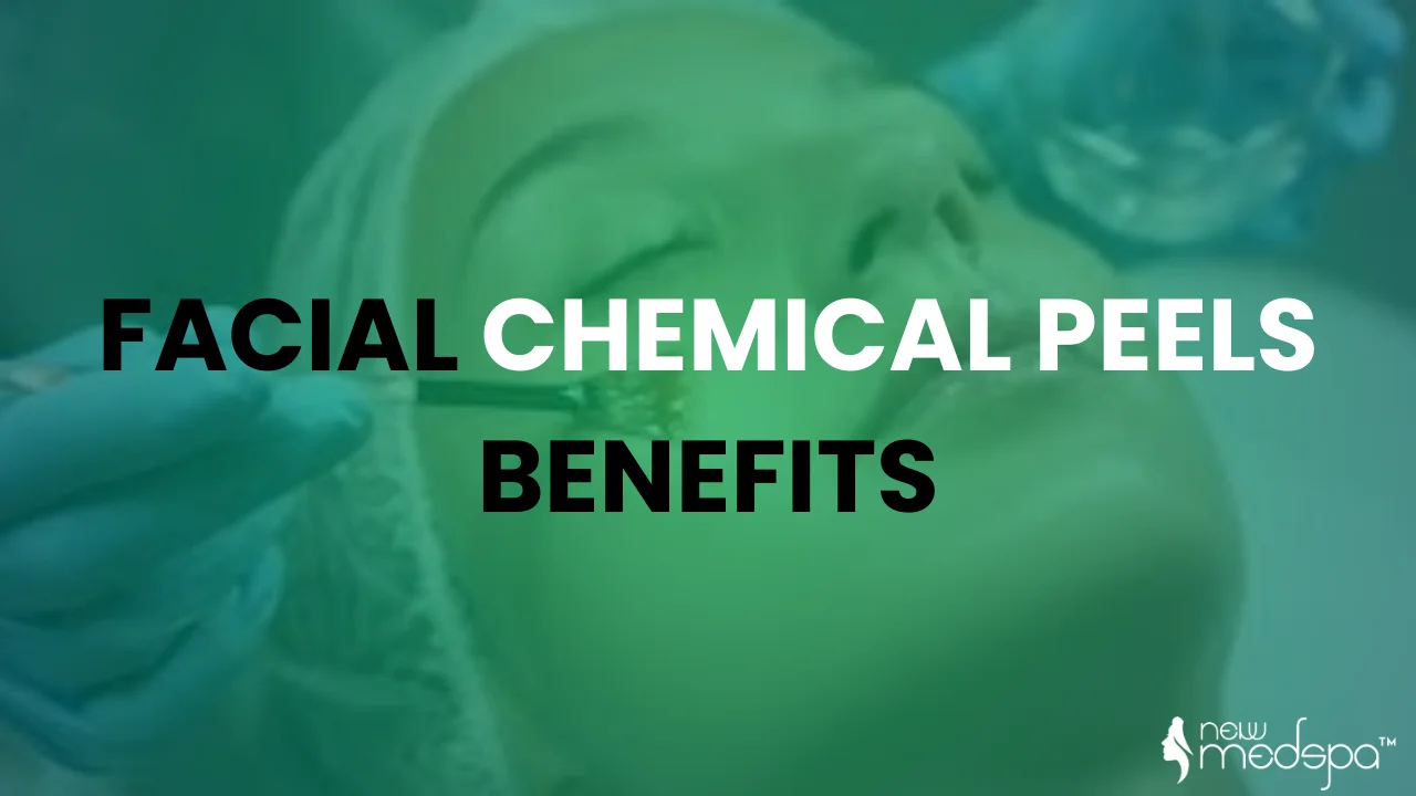 facial chemicals peels benefits