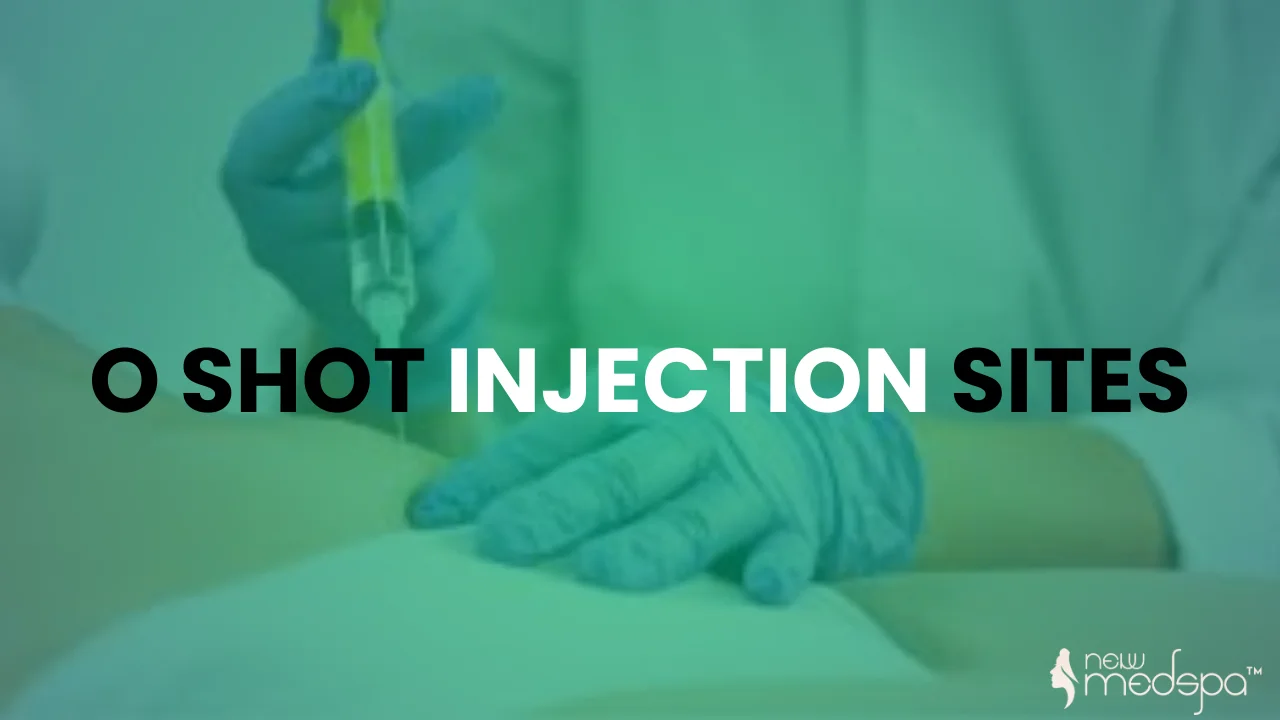 o shot injection sites