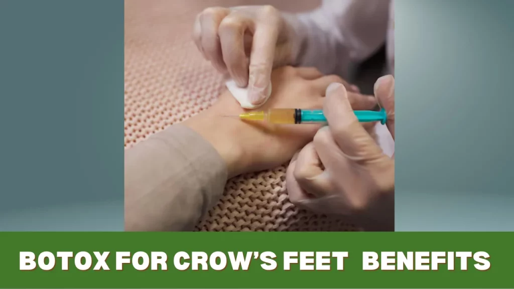 Botox for Crow’s Feet Benefits