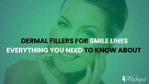 Dermal Fillers for Smile Lines