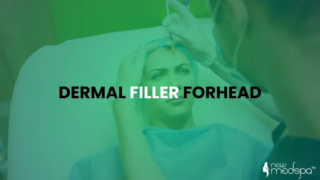 Dermal filler forehead