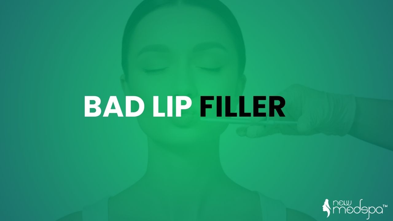 Bad Lip Filler