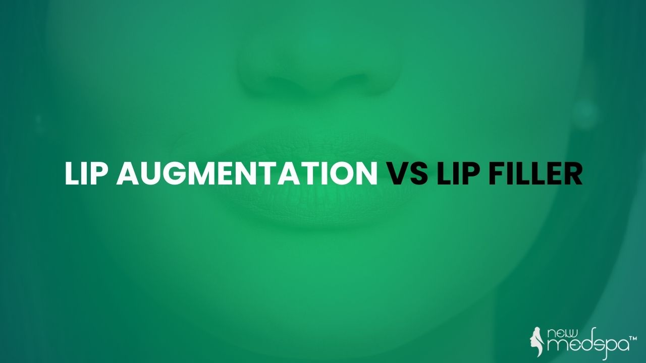 Lip Augmentation VS Lip Filler