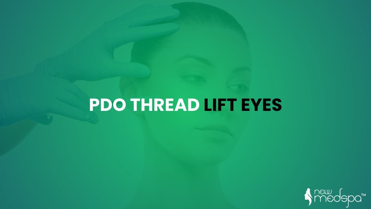 PDO Thread Lift Eyes