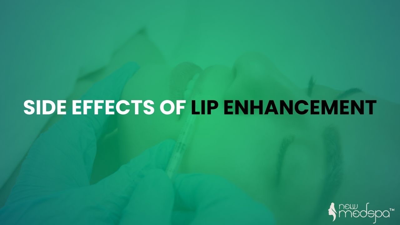 Side Effects of Lip Enhancement