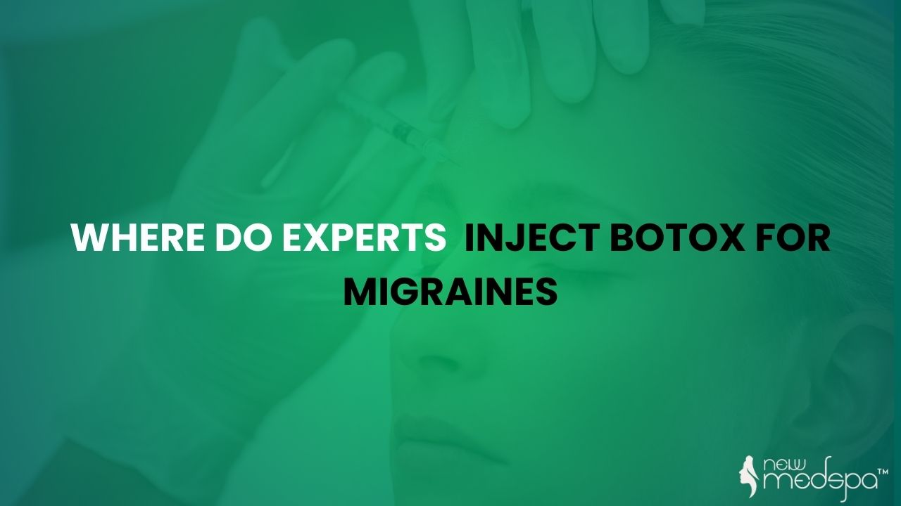 Where Do Experts Inject Botox For Migraines