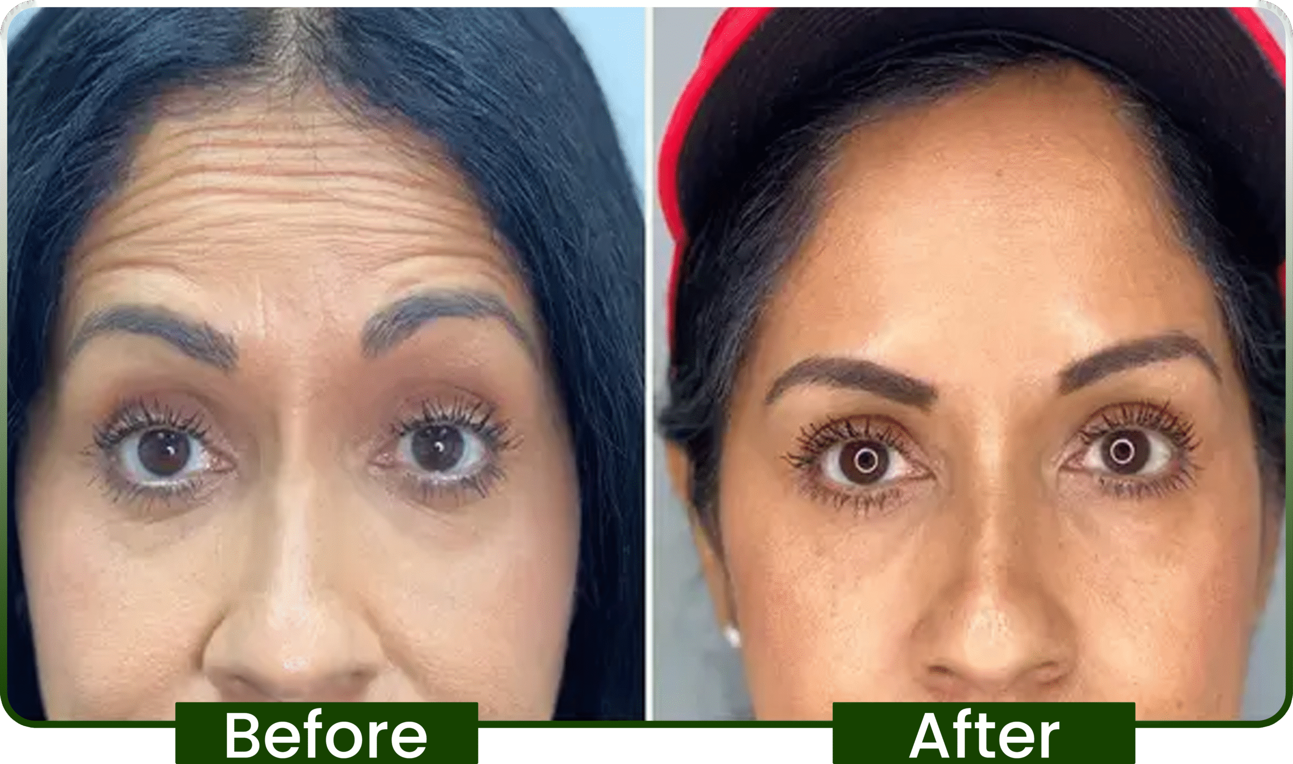 before-after-02-1-scaled.png