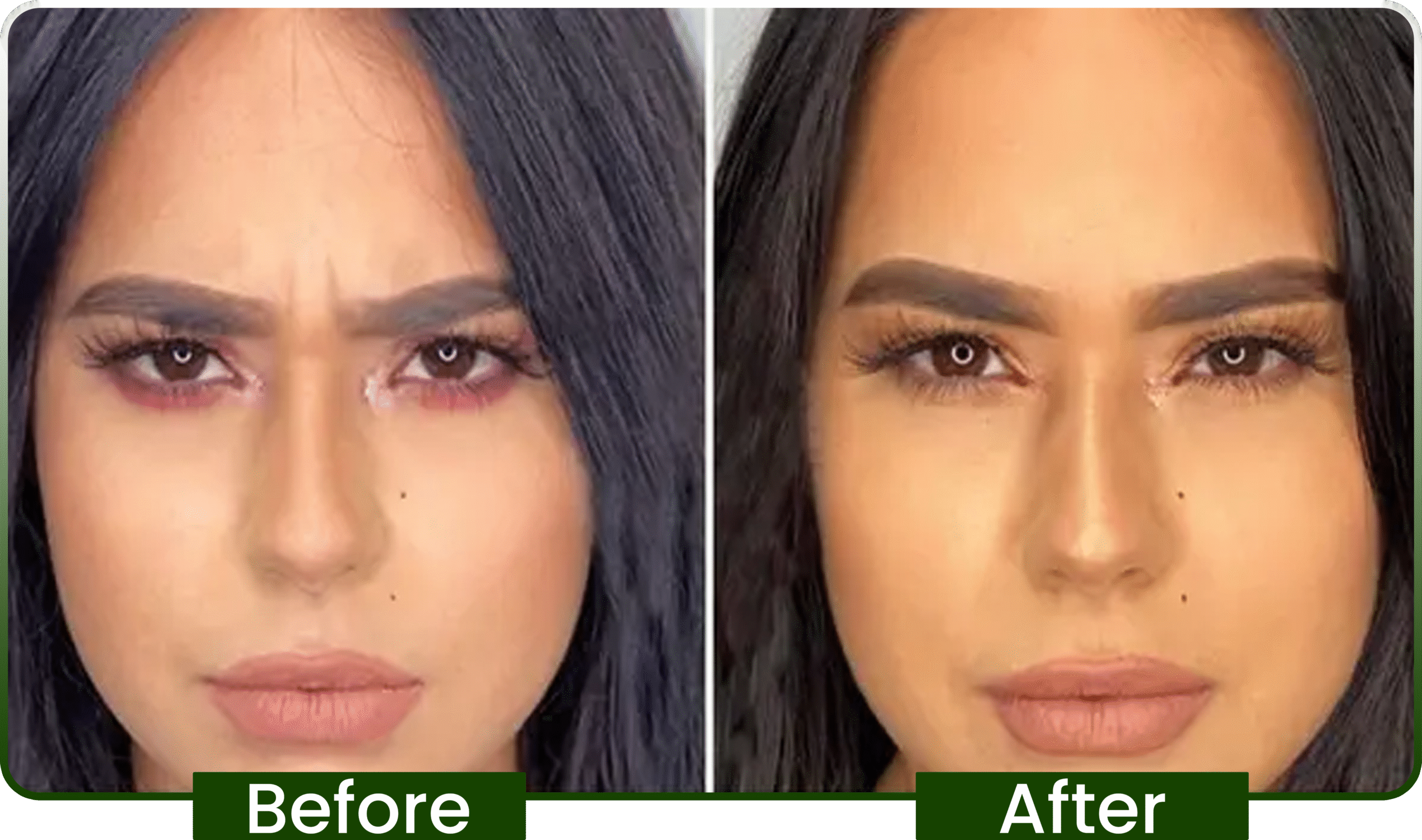 before-after-02-min-scaled.png