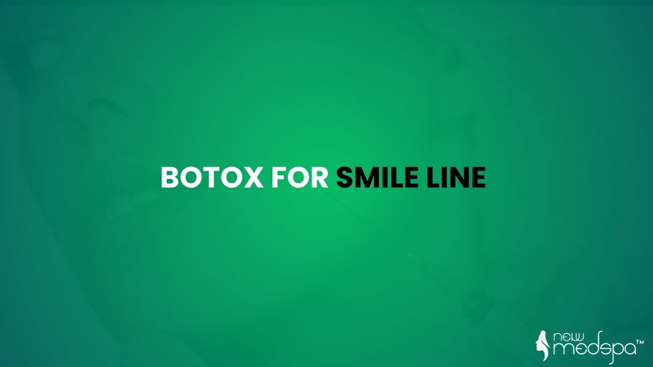 botox for smile lines