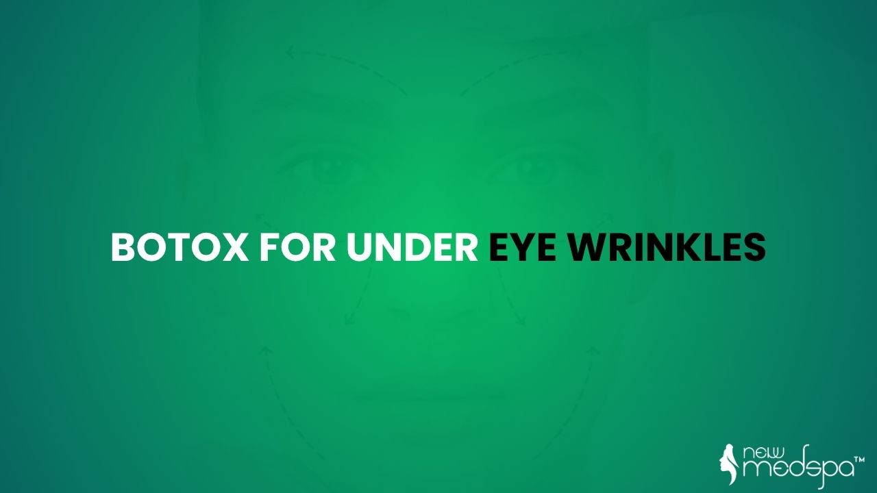 botox for under eye wrinkles